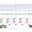 Obr. 10 Výsledky časovej synchronizácie s použitím IEEE 802.1AS v rade 50 zariadení. Meralo sa každé desiate zariadenie. Štandardná odchýlka presnosti PPS je v laboratórnych podmienkach výrazne nižšia ako 50 ns. Presnosť v rámci .1AS je definovaná ako absolútny rozdiel medzi dvoma hodinami v sieti. V našom prípade vždy meriame vzhľadom na hlavné hodiny.