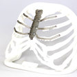3D implantáty - hrudné implantáty