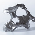3D implantáty - maxilofaciálne implantáty
