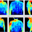 Obr. 3 Diagnostika pomocou termografie