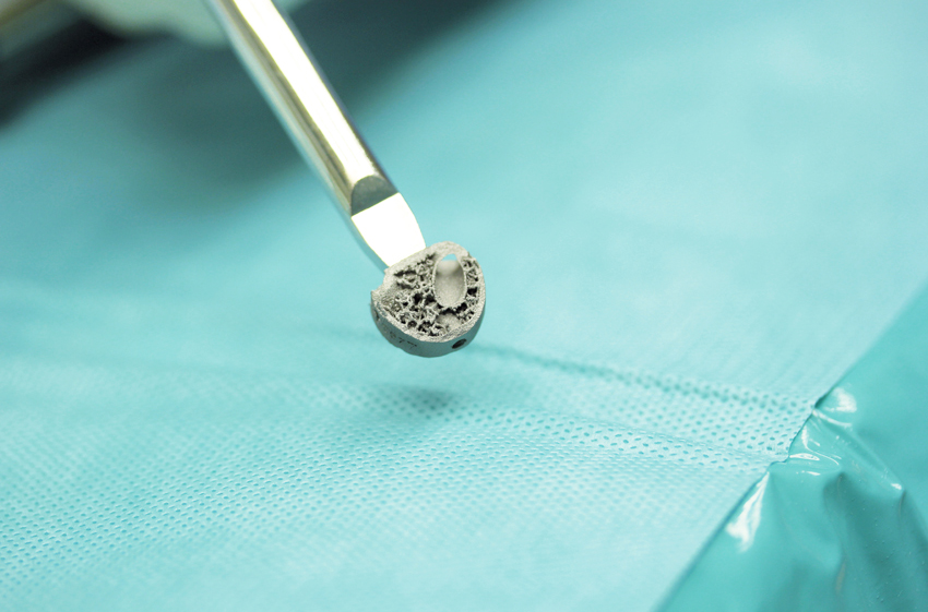 Od permanentných personalizovaných implantátov k regeneratívnej medicíne