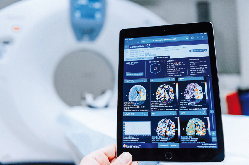 Obr.: Systém e-Stroke Suite od spoločnosti Brainomix. (Zdroj: Penta Investments)