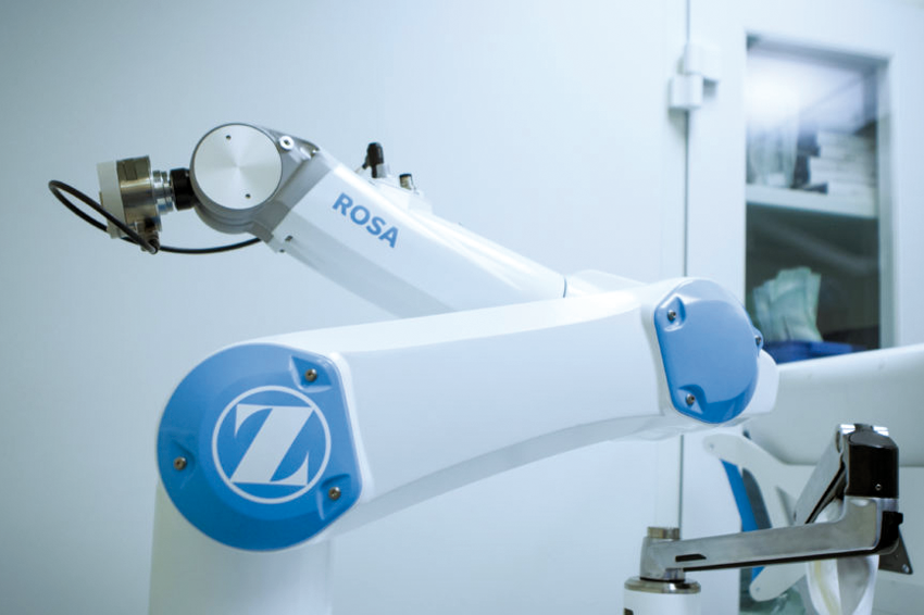 Obr.: Robotická technológia ROSA asistuje pri výmene kolenného kĺbu. (Zdroj: Zlepšujeme zdravotníctvo)